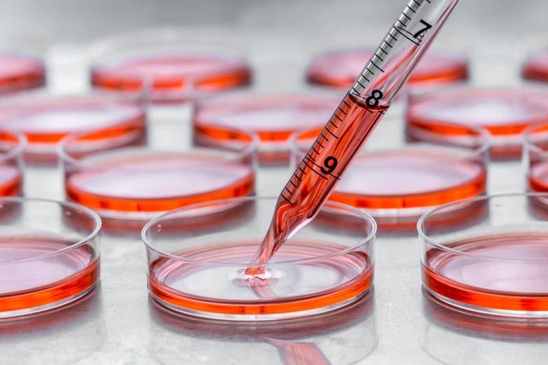 Medical Centrifuge Machine Applications | Shaanxi Achieve chem-tech Medical Centrifuge Machine Applications | Shaanxi Achieve chem-tech