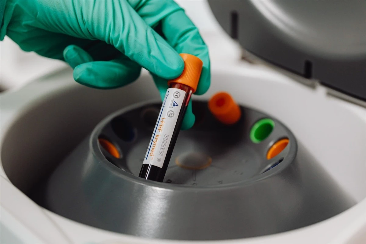 Medical Centrifuge Machine Applications | Shaanxi Achieve chem-tech Medical Centrifuge Machine Applications | Shaanxi Achieve chem-tech